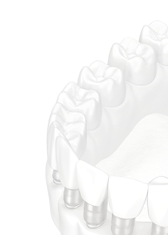 Имплантация