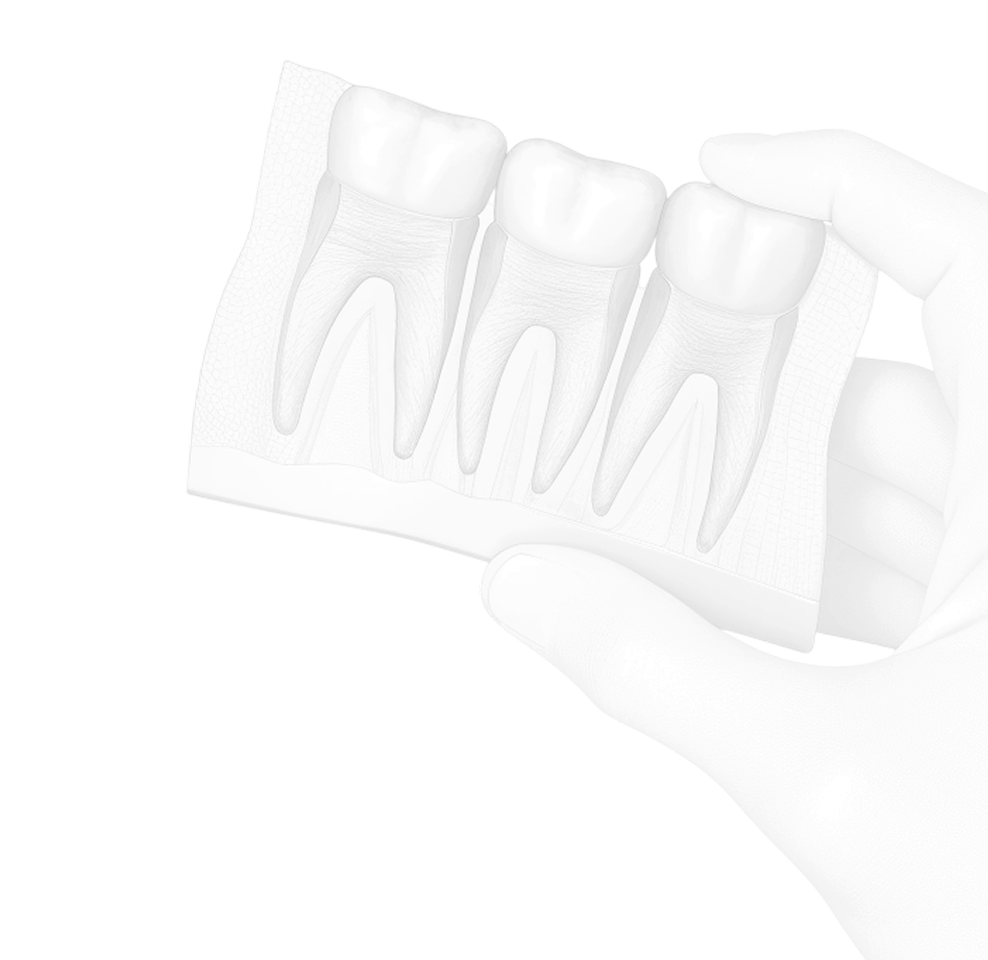 Рентген обследование