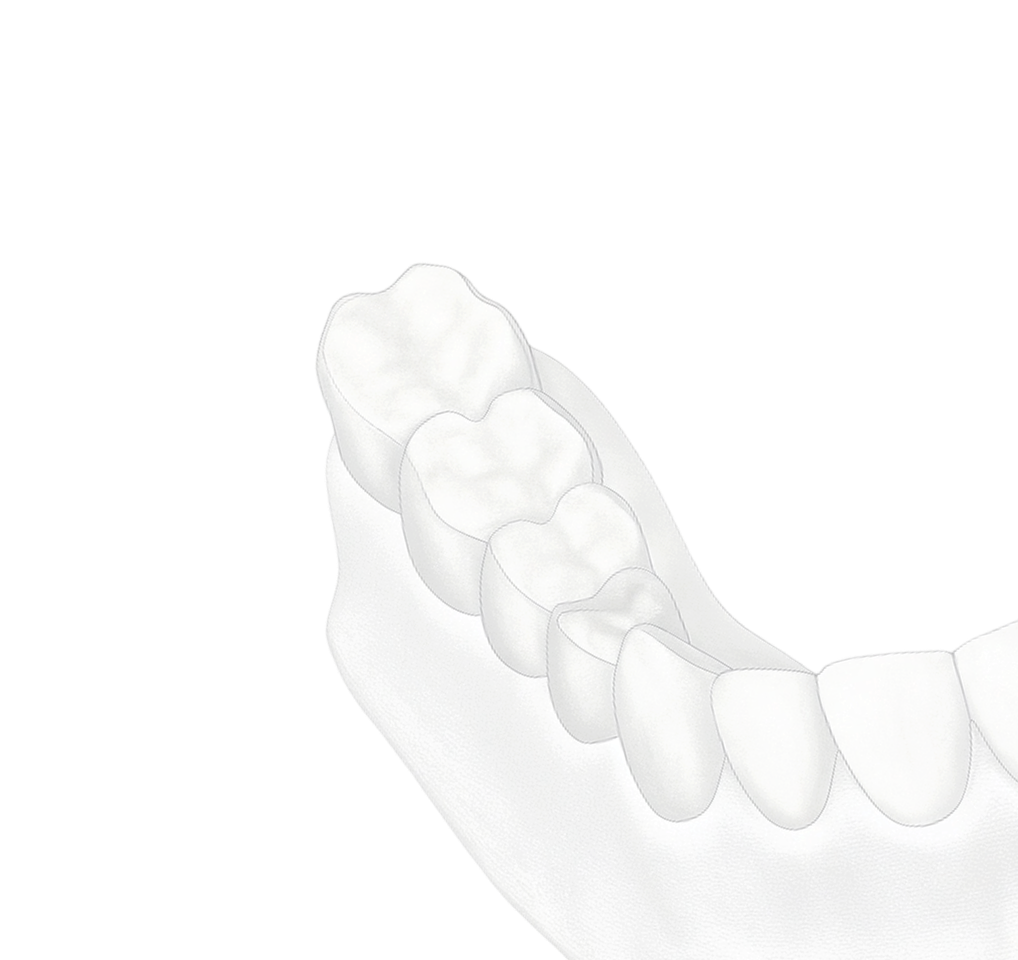 Протезирование